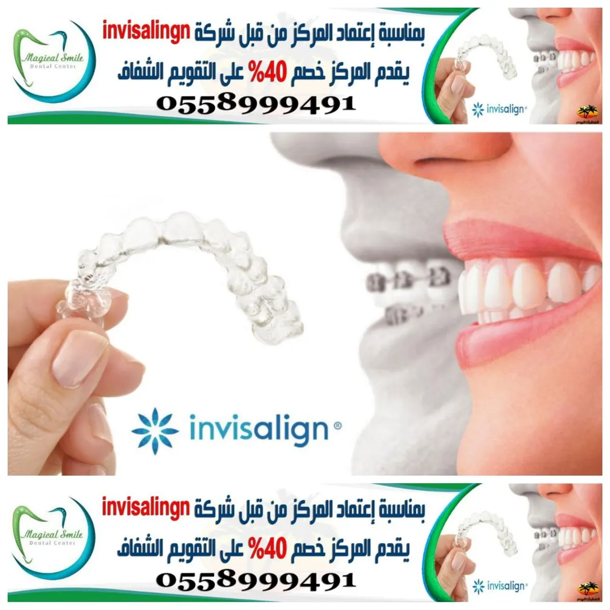 خصم 40% بمناسبة اعتماد مركز الابتسامة الساحرة من قبل شركة invisalign على التقويم الشفاف