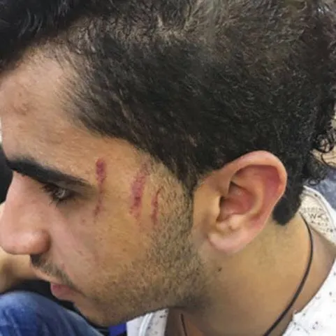 «اليد السعودية».. شغب ودماء تسيل وسيارات الإسعاف غائبة