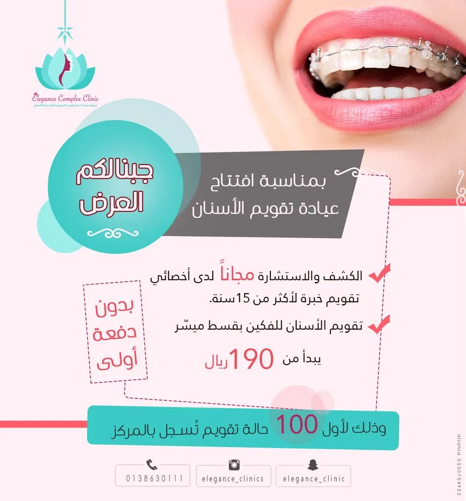 عروض عيادات «ايليجنس» لتقويم الاسنان.. بدون دفعة اولى وبقسط يبدأ من 190 ريال شهريًا
