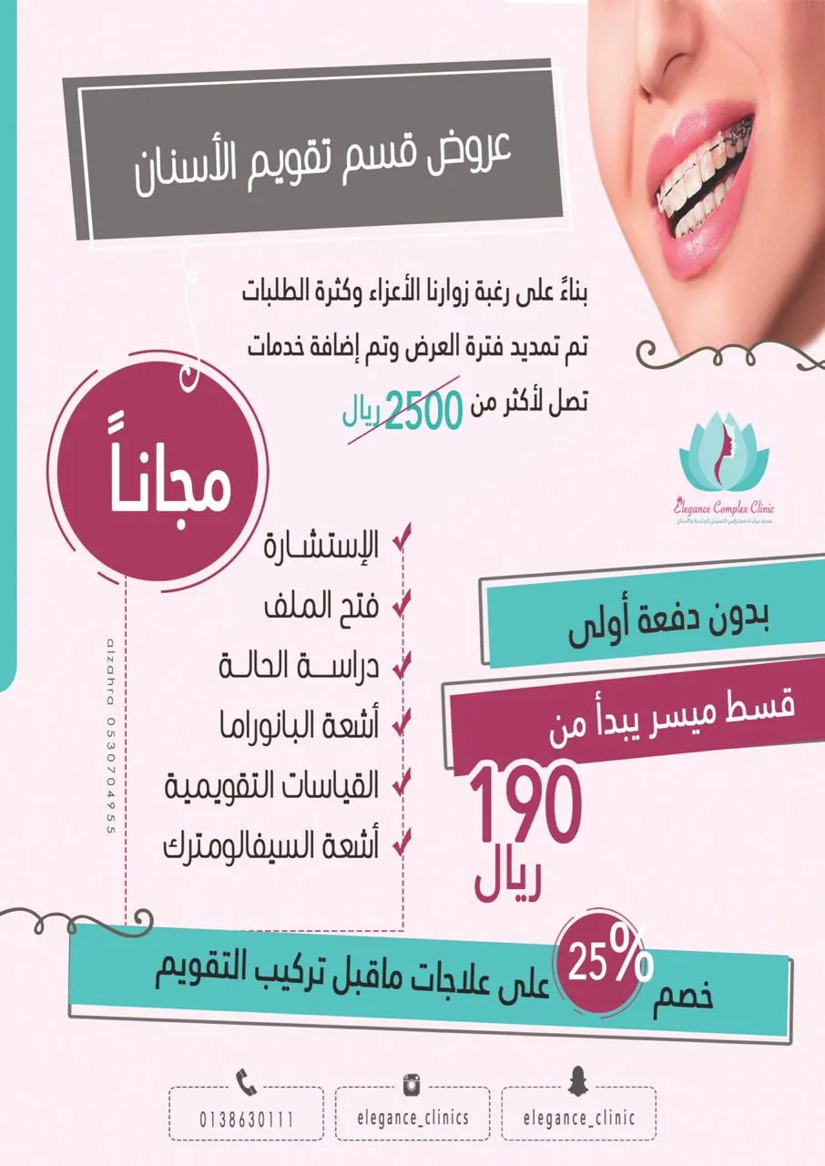 عرض حصري لتقويم الأسنان يبدأ من 190 ريالًا دون دفعة أولى.. في «عيادات إيليجنس»