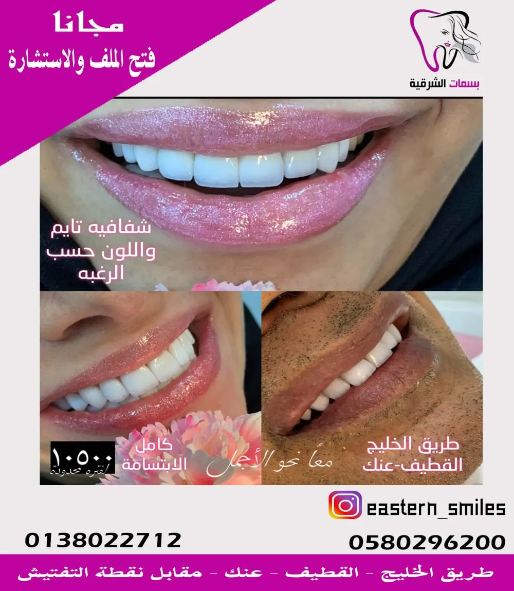 جديد عروض مجمع بسمات الشرقية لطب الأسنان بالقطيف