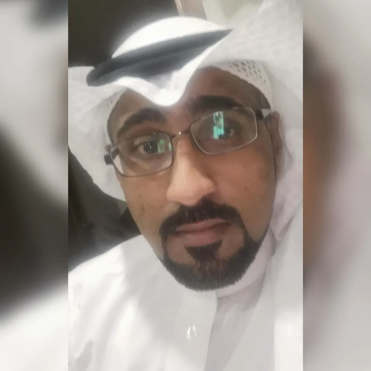 في سيهات.. ارتفاع السكر والفشل الكلوي يخطفان وظيفة علي النعيمي ونصف بصره وجزءًا من قدمه