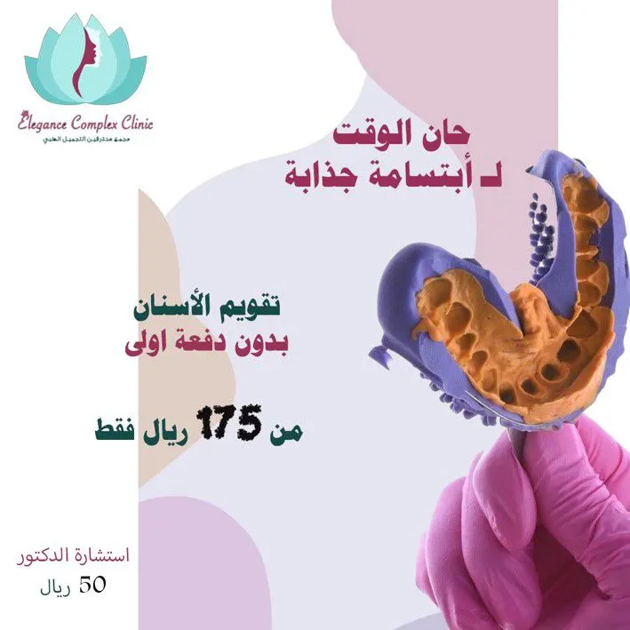 عرض تقويم الأسنان بـ175 ريالًا فقط لفترة محدودة لدى عيادات «ايليجنس»