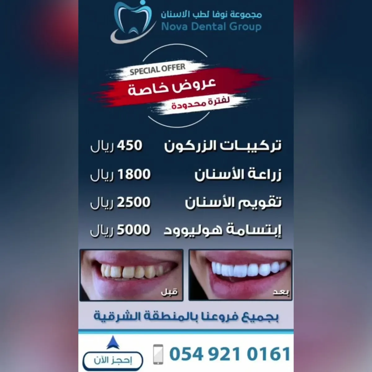 لا تفوتك عروض الأسنان في مجمع نوفا الطبي