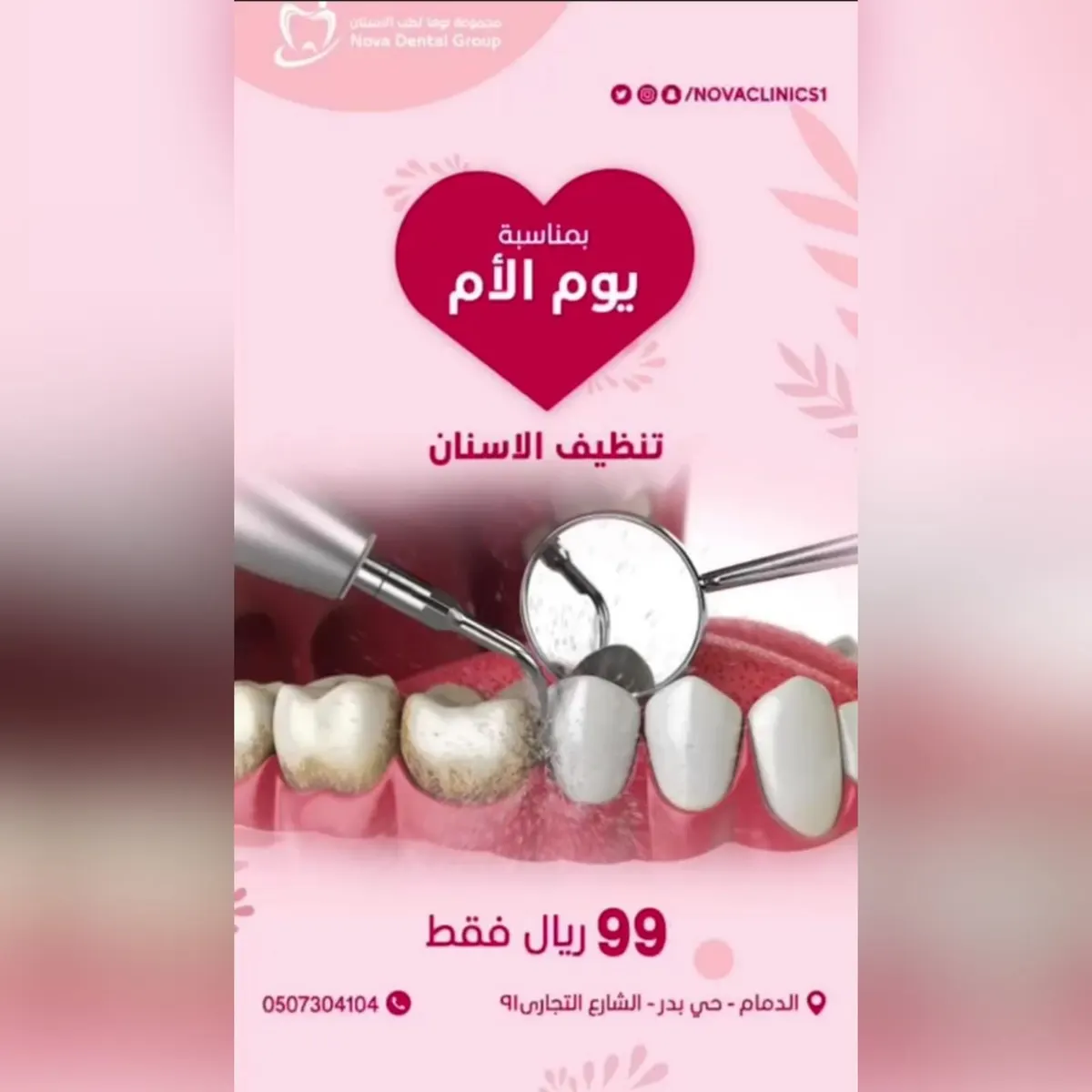 عروض يوم الأم العالمي من مجمع نوفا الطبي للأسنان
