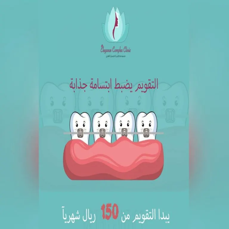 الآن في عيادات إيليجنس تقويم الأسنان بـ150 ريالاً فقط.. الحق العرض