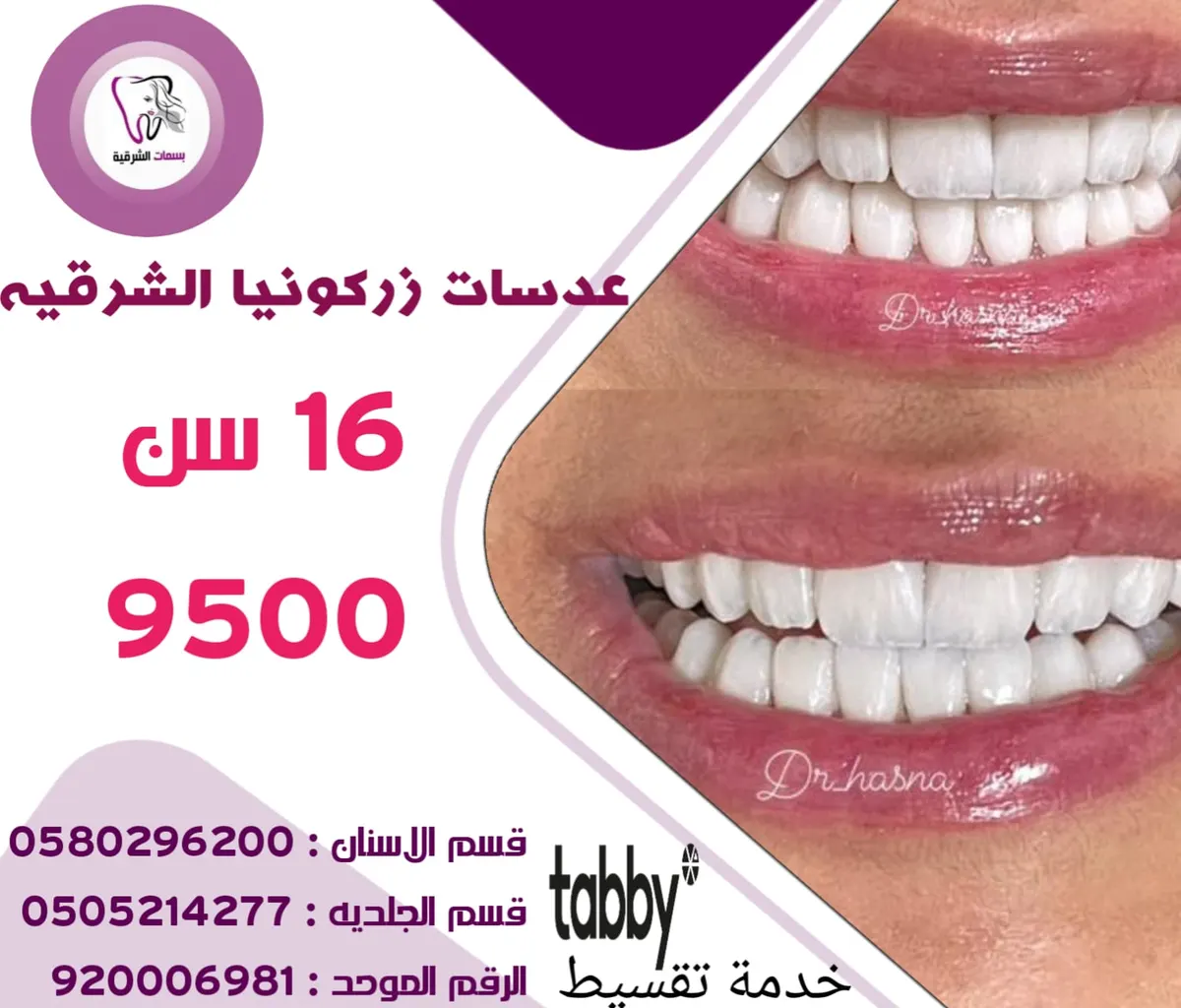 أحلى العروض العروض في انتظاركم مع «مجمع بسمات الشرقية الطبي»