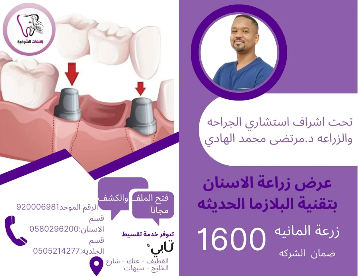 أقوى عرض على زراعة الأسنان بتقنية البلازما الحديثة في «مجمع بسمات الشرقية الطبي»