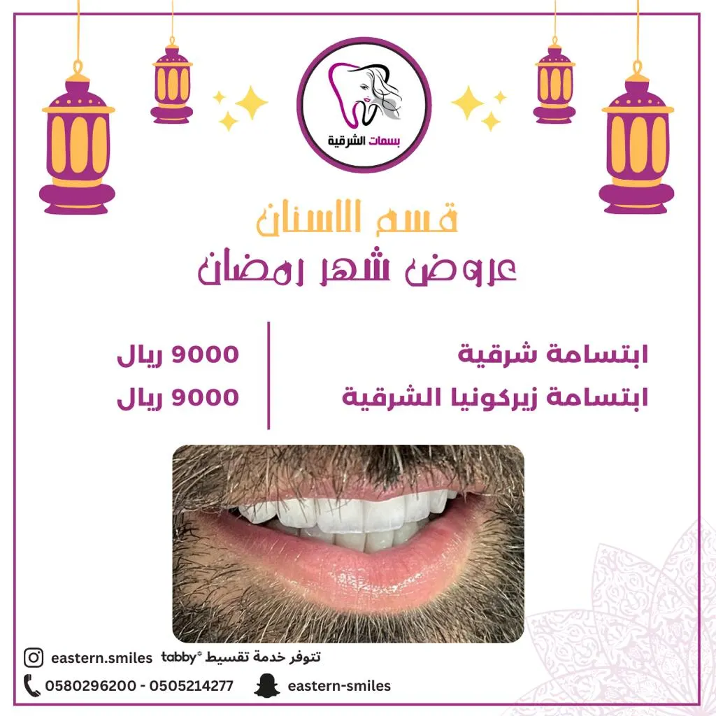 الآن بسعر مميز خلي ابتسامتك شرقيه للعيد