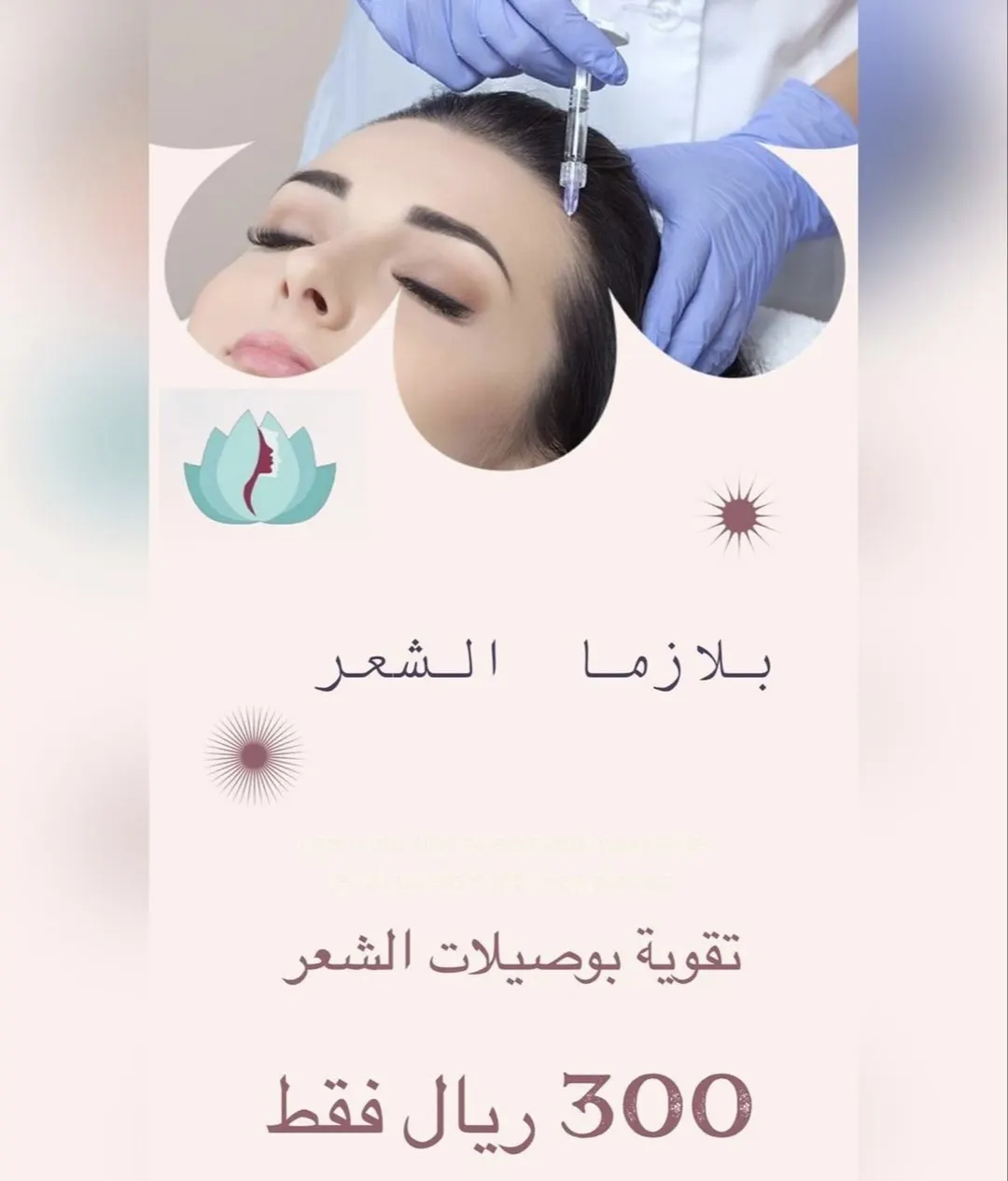 الآن مع «عيادات إيليجنس».. بلازما الشعر بـ300 ريال فقط