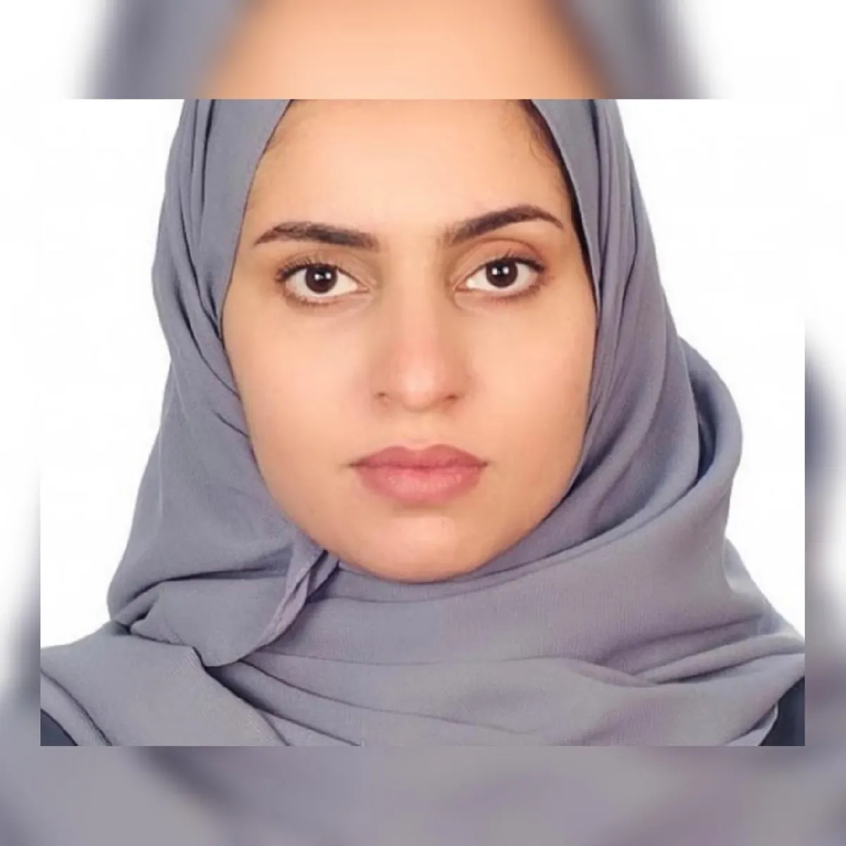 بمشاركة الدكتورة دانيا الدهان.. فريق طبي في «التخصصي» يُعيد البصر لسيدة بزراعة قرنية صناعية متقدمة هي الأولى في الشرق الأوسط