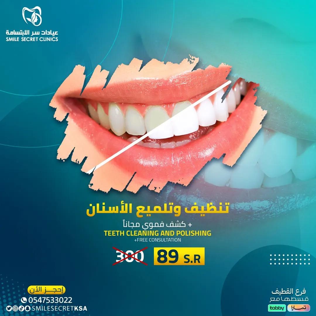 بدءًا من 89 ريالًا.. اغتنموا جديد عروض «عيادات سر الابتسامة» بالقطيف