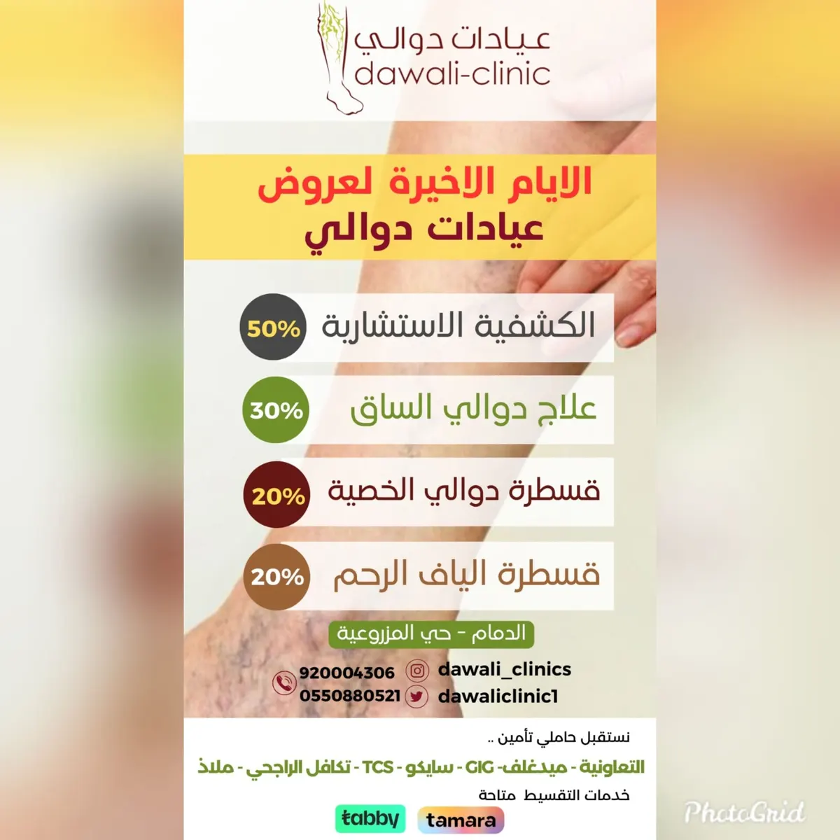 اغتنموا فرصة الأيام الأخيرة لعروض «عيادات دوالي»