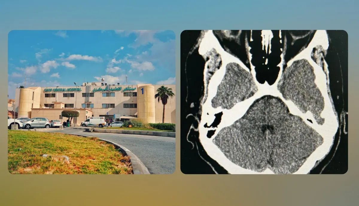 أصيبت بأداة زراعية.. «مركزي» القطيف ينقذ عين وافد ثلاثيني بعملية جراحية معقدة