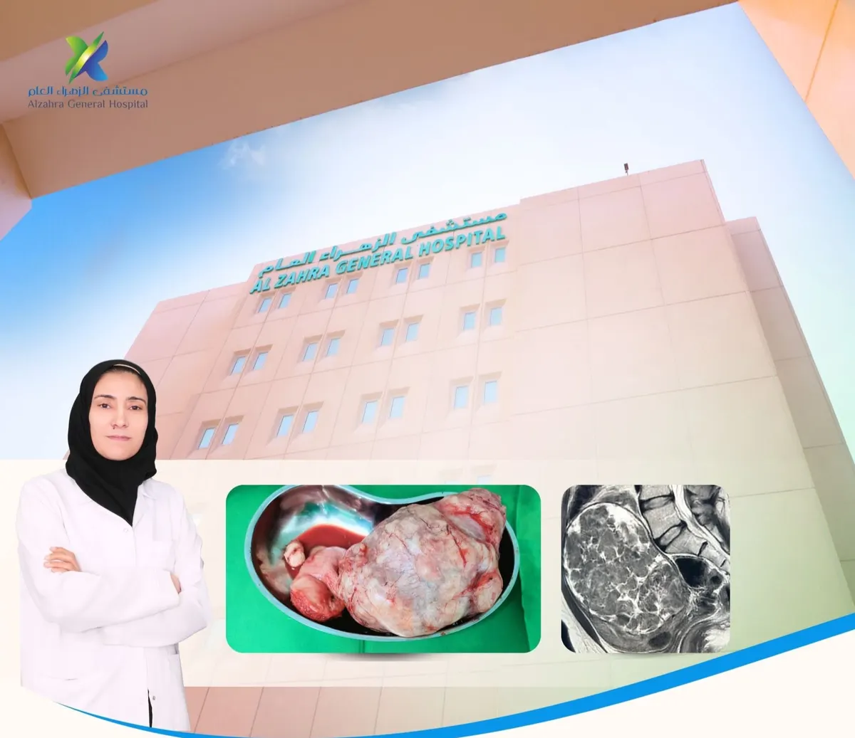 في القطيف.. «مستشفى الزهراء العام» يتمكن من استئصال ورم كبير لمريضة بعد معاناة من الآلام