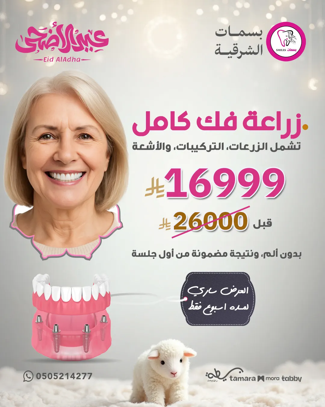 زراعة فك كامل بـ 16,999 ريال بس في مجمع بسمات الشرقية