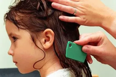 قمل الرأس.. نصائح لحماية الأطفال في المدارس