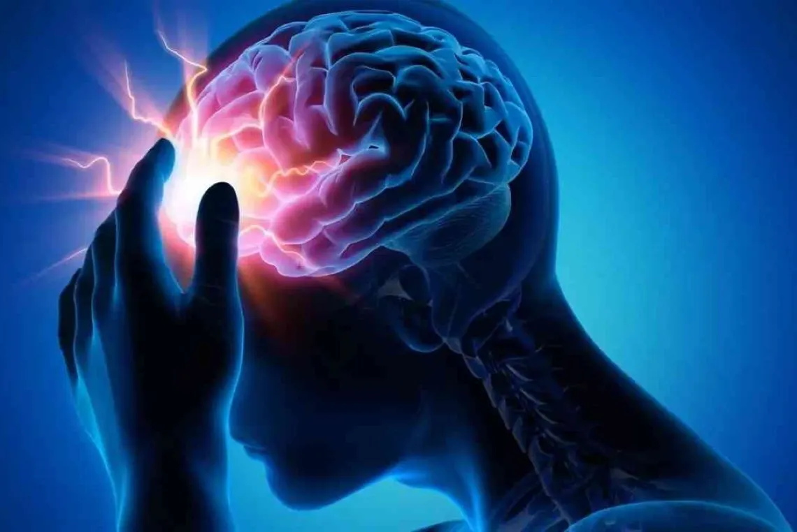 عالم أبحاث: التحكم بالضغط والكوليسترول يقي من السكتة الدماغية