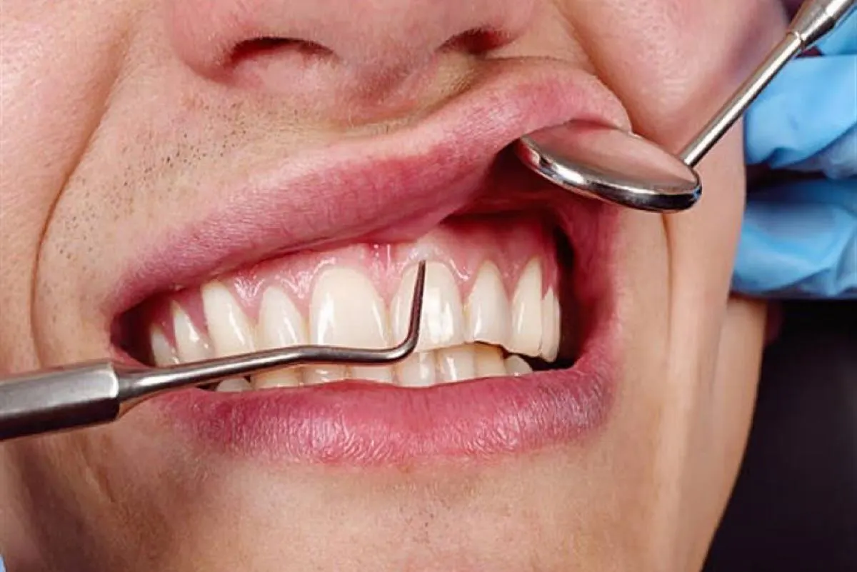 تطوير دواء يساعد على انبات أسنان جديدة