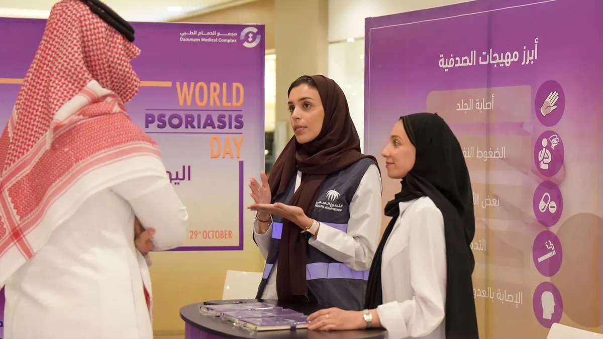 التوتر والضغوط النفسية.. تعرف على أبرز المهيجات لمرض الصدفية