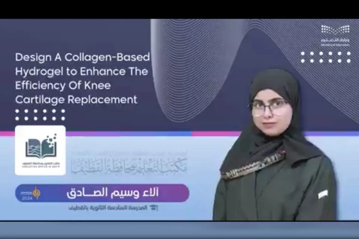 «هيدروجيل» لاستبدال الغضروف.. مشروع للطالبة «آلاء الصادق»