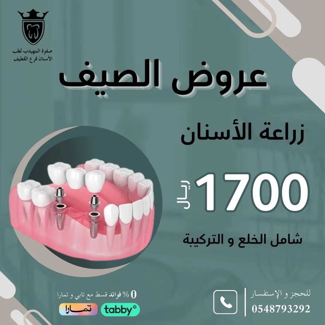 زراعة الاسنان بـ 1700 ريال