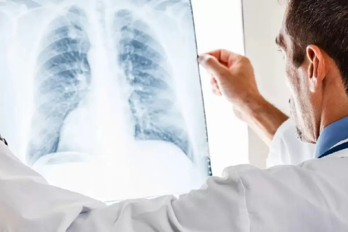 الذكاء الاصطناعي يهدد خصوصية المعلومات الطبية