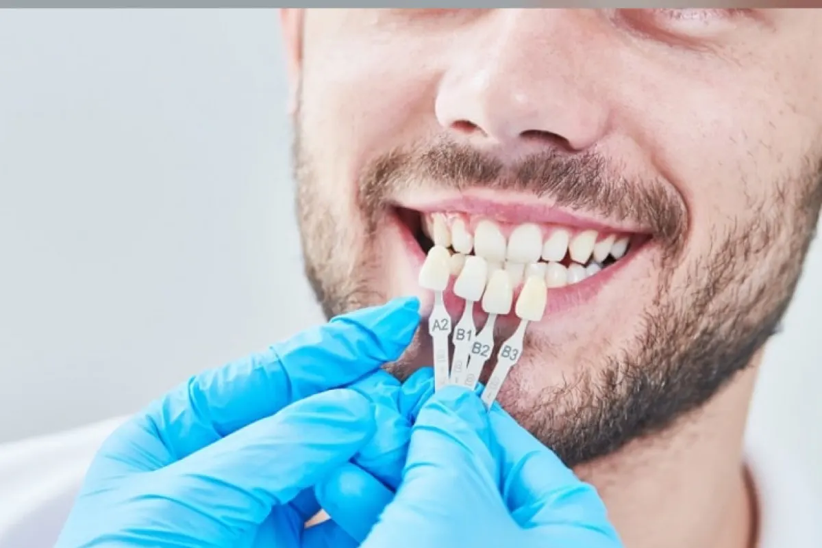 هل ستصبح أسعار علاج الأسنان موحدة قريبًا؟ استشاري يجيب