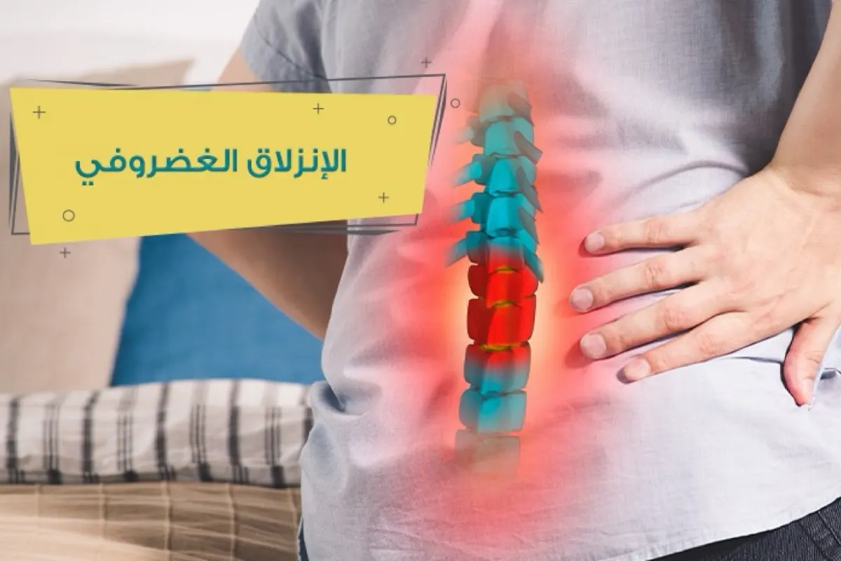 مرضى الانزلاق الغضروفي.. احذروا تنميل الأطراف