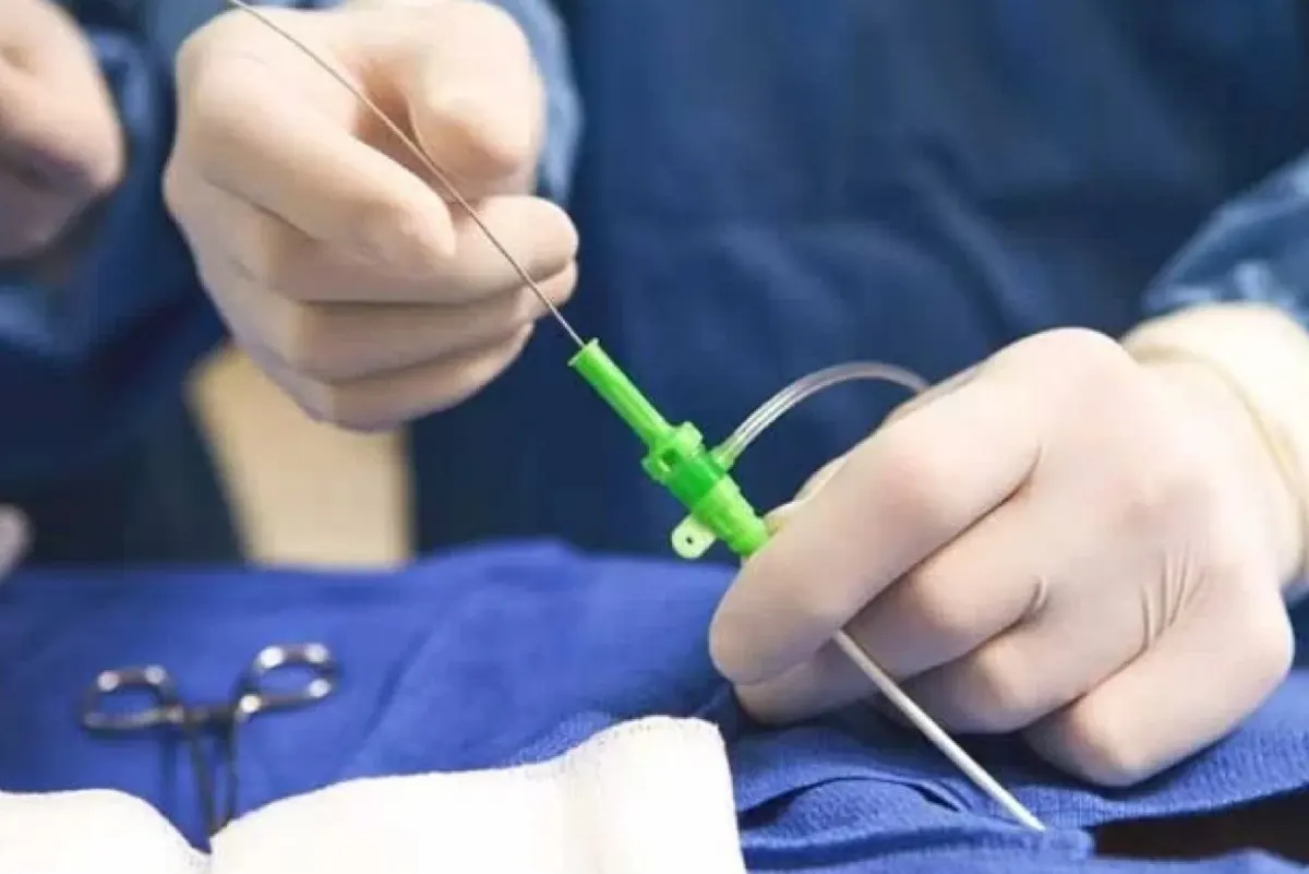 استشاري أمراض القلب يحذر: القسطرة الطبيعية لا تعني سلامة الشرايين التاجية