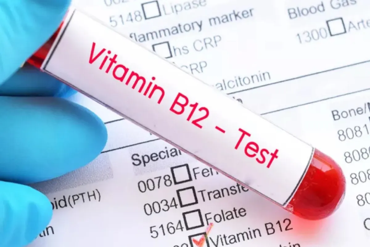 لا فحوصات روتينية للأصحاء.. ضوابط جديدة لفحص B12 لخفض التكاليف الطبية