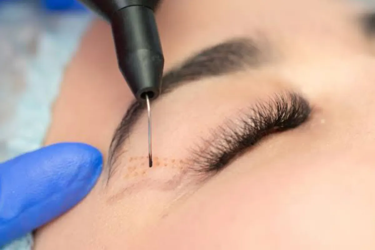 استشاري: تجميل الجفون آمن جداً والمضاعفات الخطيرة نادرة