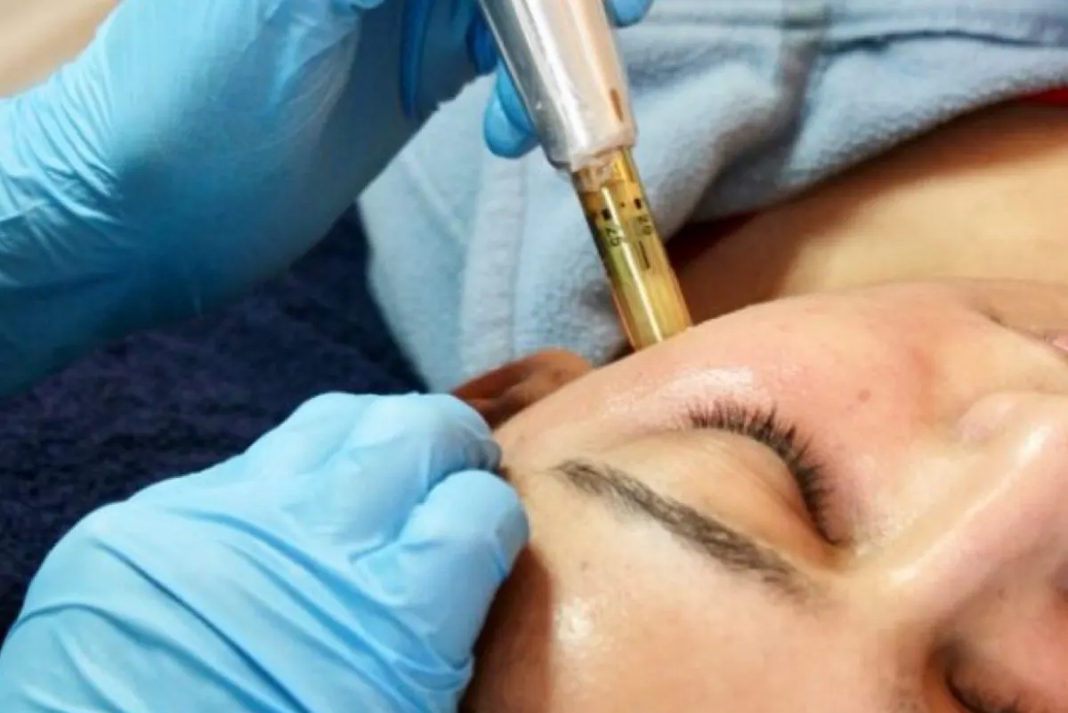 هل تسبب إكسوزومات التجميل السرطان؟.. جمعية الجلدية تجيب