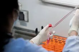 [كورونا] 29 متعافياً في القطيف اليوم.. ويتبقى 38 مصاباً فقط