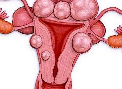 خطأ طبّي يفتح شرياناً داخل رحم “أنوار”.. و 5 عمليات جراحية بلا فائدة
