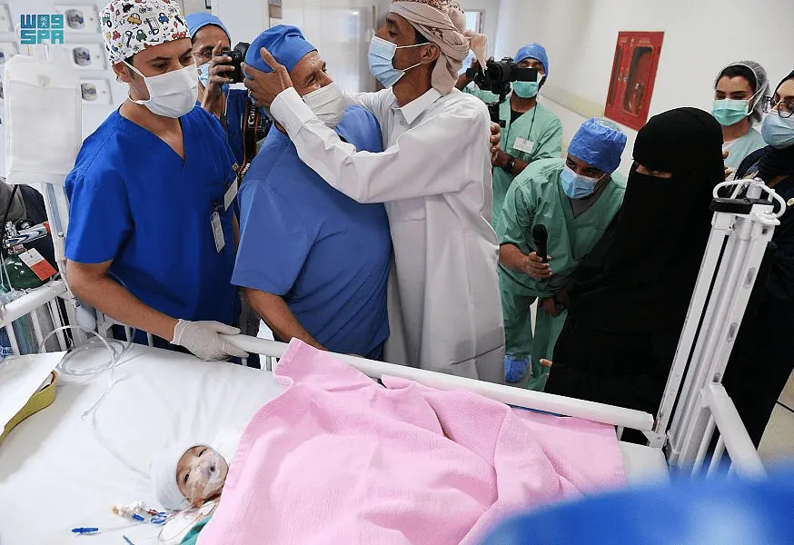 [صور] قُبلة للربيعة تُعلن نجاح فصل التوأم اليمني عائشة