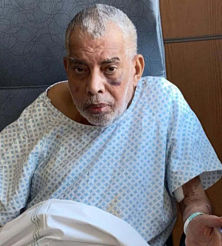 حكيمة دعبل.. أنقذت شقيقها بمنحه أكثر من نصف كبدها