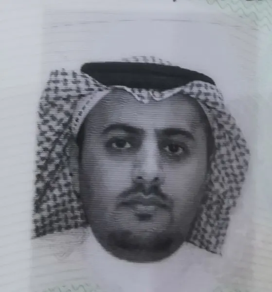 يا وزير التعليم.. الورم سرق بصر علي آل خالد.. والمدارس ترفض تسجيل أولاده