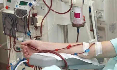أنقذوا عقيلة من آلام ربع قرن.. تنتظراً متبرعاً بكلية