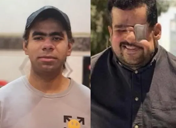 الحمود والعرفات.. “مَهديّان” كفيفان تحدَّيا السرطان والبطالة