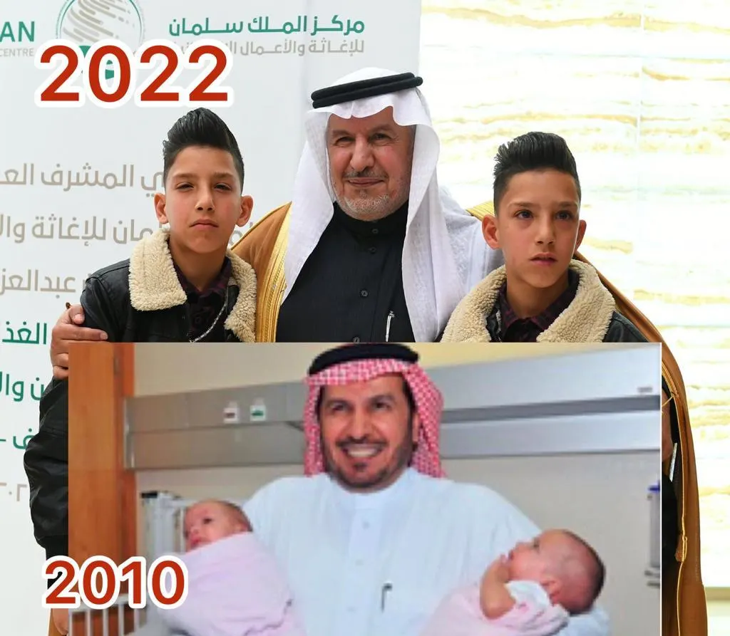 فصلهما رضيعين.. والتقى بهما شابّين