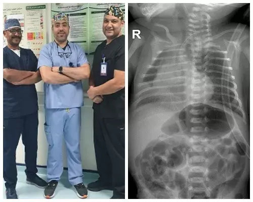القطيف.. تفاصيل جديدة عن عملية الـ 3 ساعات لمولودة الخفجي