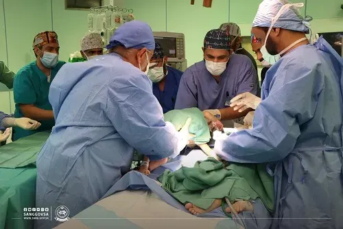 نجاح فصل السيامي السوري “إحسان” عن “بسام” في 7 ساعات ونصف