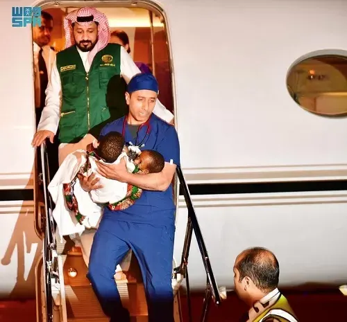 [صور] السيامي التنزاني “حسن وحسين” في الرياض