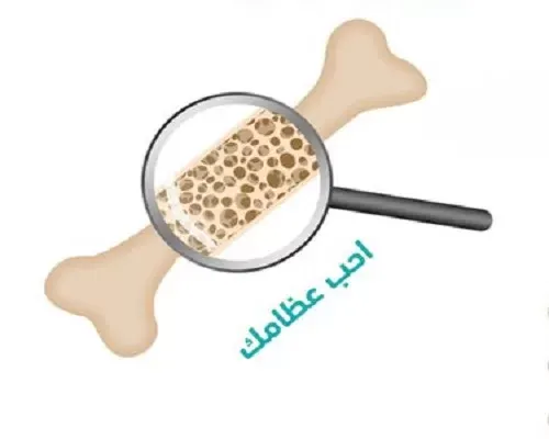 في اليوم العالمي لهشاشة العظام الخميس.. “احب عظامك” في سيتي مول القطيف