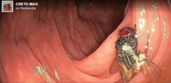 في أمريكا.. فتحوا بطنه لعملية.. فوجدوا “دبّانة” على قيد الحياة