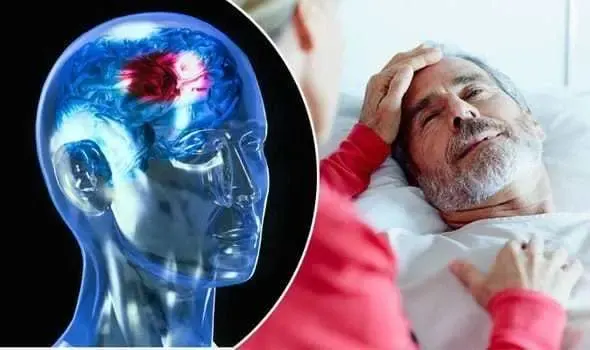 احذر 4 علامات في العين تنذر بالسكتة الدماغية