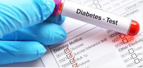 هل يحتاج تحليل السكر التراكمي لصيام عدد ساعات معين؟