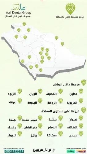 لا تفوتكم أقوى عروض عاجي على جميع خدمات الأسنان