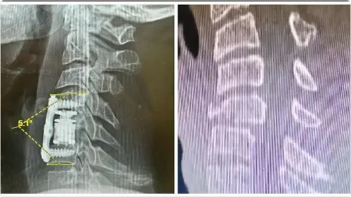 الطائف.. إنقاذ شاب سقط من ارتفاع ٦ أمتار